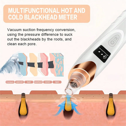 Aspirateur Électrique pour Points Noirs – Nettoyeur de Pores et Soin du Visage Rechargeable