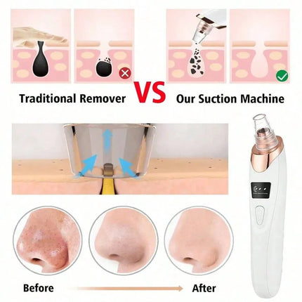 Aspirateur Électrique pour Points Noirs – Nettoyeur de Pores et Soin du Visage Rechargeable